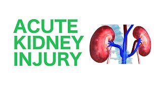 Acute Kidney Injury AKI  USMLE [upl. by Asiulairam]