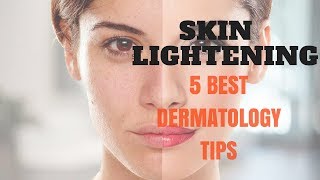 SKIN LIGHTENING 5 Best Dermatology Tips [upl. by Siddra677]