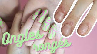 Tutoriel EXTENSION CHABLON 💅🏻 sur ONGLES RONGÉS avec des bobos 🩹 partout [upl. by Ashlen]