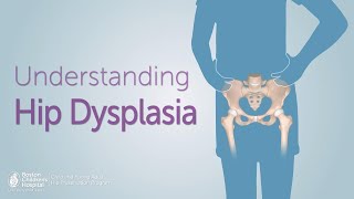 My Disability  EEC Syndrome  Ectodermal Dysplasia [upl. by Ahs815]