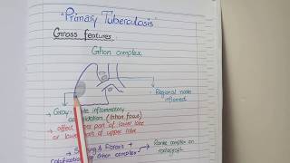 Tuberculosis Pathology  Primary and Secondary TB [upl. by Queridas]