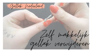 GELLAK VERWIJDEREN  Uitgebreide uitleg  Gellak Nederland [upl. by Cleti222]