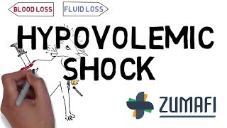 Hypovolemic shock  Introduction amp Causes [upl. by Haland959]