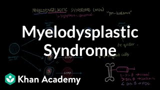 Know the Signs of Ectodermal Dysplasias [upl. by Archaimbaud]