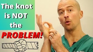 Why Muscle Knots Are Not The Problem [upl. by Suoivart]