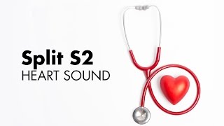 Fixed Split S2  Heart Sounds  MEDZCOOL [upl. by Gies]