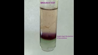 Molisch Testa group test for Carbohydrates [upl. by Bannerman]