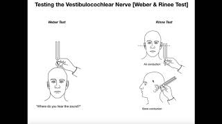 Interpreting the WeberRinne Tests EXPLAINED [upl. by Dnalwor]