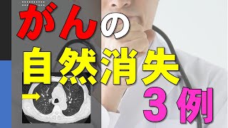 がんが自然に治る！自然消失・退縮の３例（乳がん、大腸がん、肺がん） [upl. by Jolene]