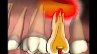 Paranasal Sinuses [upl. by Ariaic242]