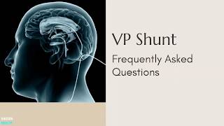 VP Shunt Frequently Asked Questions [upl. by Cir]