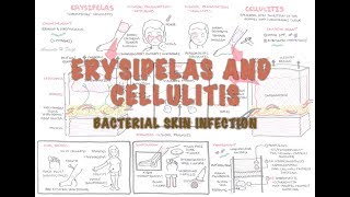 Bacterial Skin Infection  Cellulitis and Erysipelas Clinical Presentation Pathology Treatment [upl. by Castora]