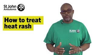 How to Treat Heat Rash  First Aid Training  St John Ambulance [upl. by Tijnar]