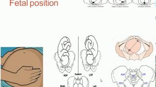 Fetal lie presentation and position [upl. by Caritta]