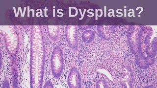 Gastrulation  Formation of Germ Layers  Ectoderm Mesoderm and Endoderm [upl. by Ragde716]