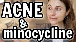 Minocycline versus doxycycline for acne Dr Dray [upl. by Nilknarf]