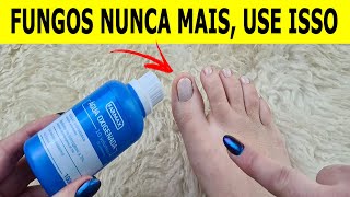 NUNCA MAIS TIVE FUNGOS E MICOSE NAS UNHAS DEPOIS QUE VI ESSA RECEITA [upl. by Orrocos]