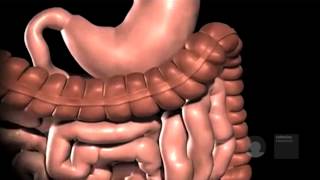 Gastric bypass in het Obesitascentrum Catharina Ziekenhuis [upl. by Hebbe478]