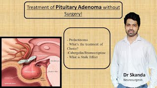 HIPERPROLACTINEMIA AUMENTO DE PROLACTINA  ENDOCRINOLOGIA [upl. by Serica738]