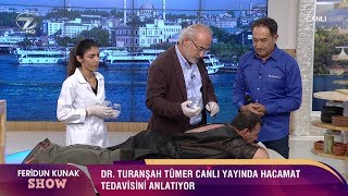 Hacamat Nasıl Yapılır Canlı Yayında Hacamat Tedavisi [upl. by Acisej]