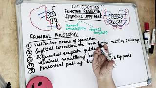 frankel appliance in orthodontics part 1 [upl. by Draneb]