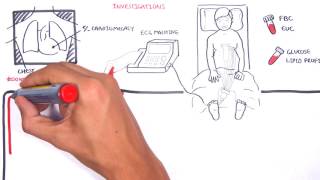 Acute Coronary Syndrome DETAILED Overview MI STEMI NSTEMI [upl. by Badr]