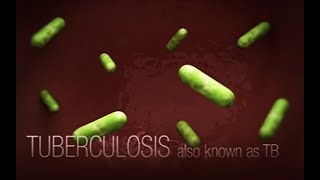 CDC Tuberculosis TB Transmission and Pathogenesis Video [upl. by Aitnauq]