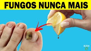 FUNGOS NAS UNHAS 👉 Aplique LIMÃO Para ELIMINAR os Fungos Rapidamente [upl. by Ker]