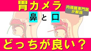 【胃カメラ】鼻からと口から、どちらがオススメ？内視鏡専門医が解説。 [upl. by Dotty]