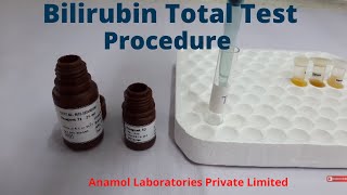 Bilirubin Test Procedure  Bilirubin Total Test [upl. by Ymerrej379]