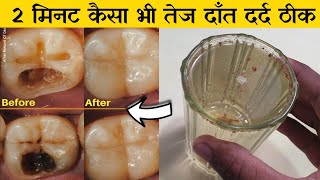 2 मिनट  दाँतो की तेज दर्द का 100 पक्का ईलाज  Teeth pain home remedy [upl. by Osrit]