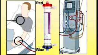 Setting Up of Dialysis Machine [upl. by Aneel]