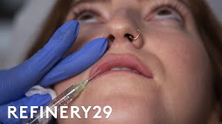 I Got Lip Filler Injections For The First Time  Macro Beauty  Refinery29 [upl. by Tanney]