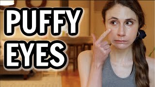 How to get rid of puffy eyes Dr Dray [upl. by Candide587]