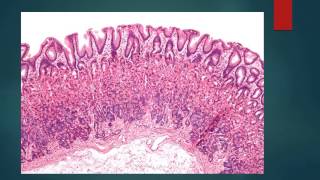 HISTOLOGIA DEL ESTOMAGO [upl. by Conchita]