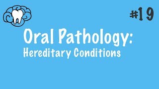 Oral Pathology  Hereditary Conditions  INBDE ADAT [upl. by Anwaf]