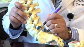 Surgical Procedures  Lumbar Laminectomy amp Discectomy [upl. by Reis]