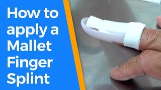 How to splint a mallet fingerfinger splints [upl. by Ecnahoy]