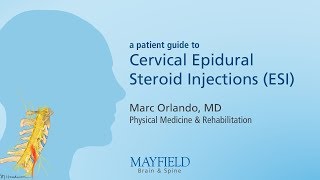 Cervical Epidural Steroid Injection [upl. by Ajtak191]