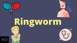 Ringworm Causes Signs and Symptoms Diagnosis and Treatment [upl. by Ayotan]