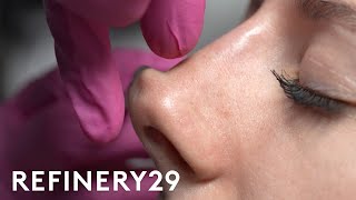 I Tried A NonSurgical Nose Job  Macro Beauty  Refinery29 [upl. by Brewer56]