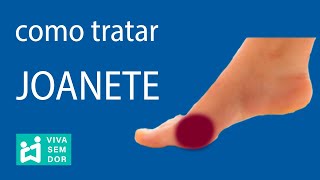 Como tratar joanete [upl. by Terrie]