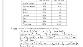 Vascular Shunt [upl. by Carrick]