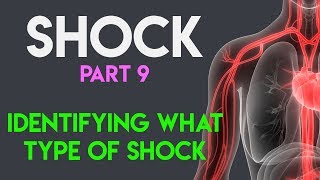 Identifying What Type Shock  Shock Part 9 [upl. by Oneill]