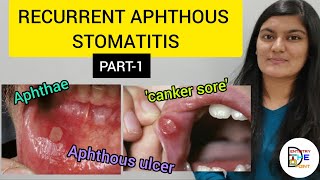 RECURRENT APHTHOUS STOMATITIS RAS PART1 [upl. by Yclek52]