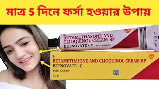 BETNOVATE C SKIN CREAM ফর্সা হবার উপায়  BETNOVATE C CREAM BANGLA REVIEW [upl. by Eliseo]