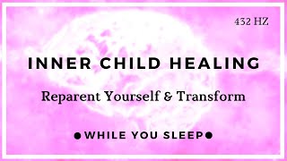 Inner Child Healing Affirmations  Reprogram Your Mind While You Sleep [upl. by Berger33]