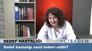 Sedef hastalığı nasıl tedavi edilir [upl. by Solana]