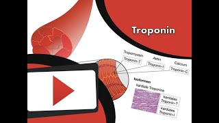 Kardiales Troponin wwwclipdocsde [upl. by Aicercul]