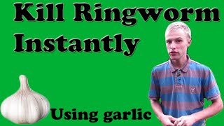 Kill Ringworm Instantly Using Garlic [upl. by Amann377]